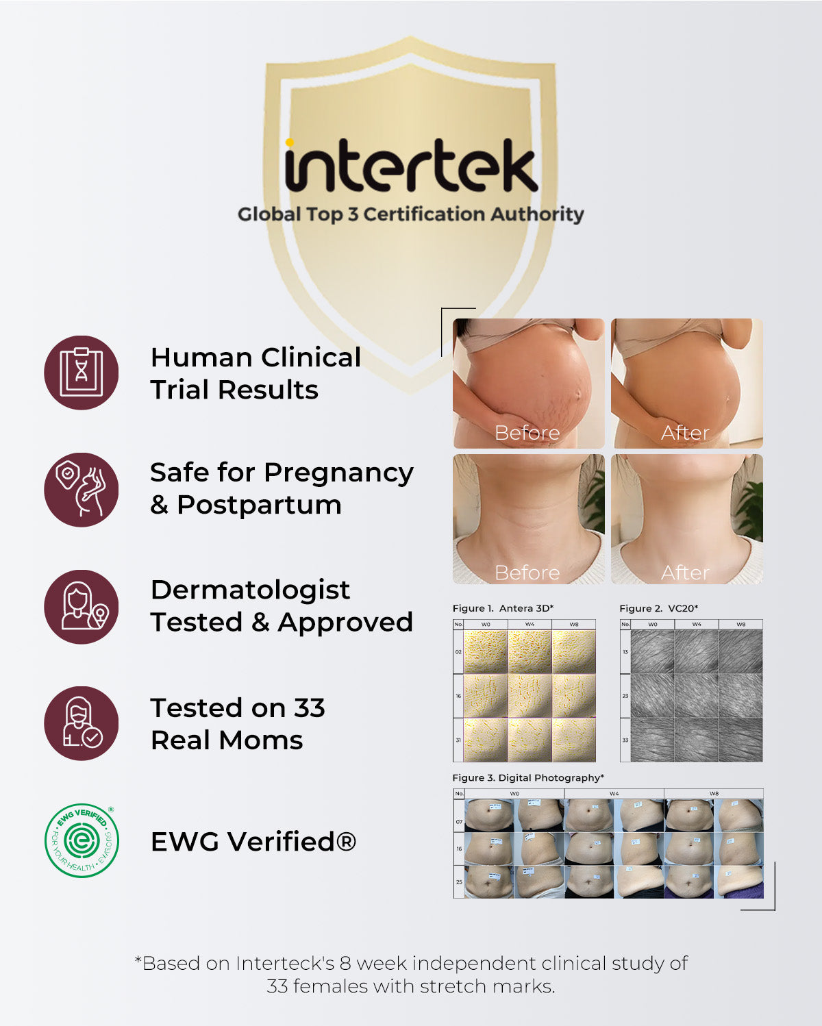 Momcozy Pro-Collagen Belly Firming Moisturizer Stretch Mark Cream