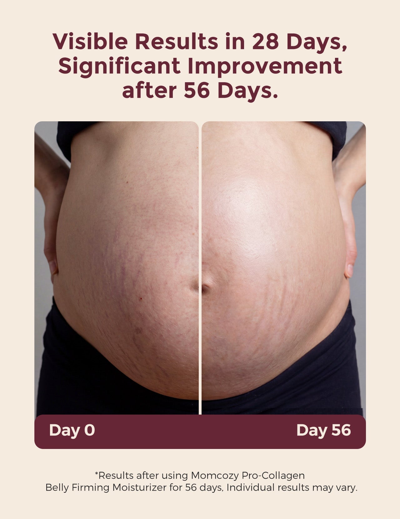 Momcozy Pro-Collagen Belly Firming Moisturizer Stretch Mark Cream