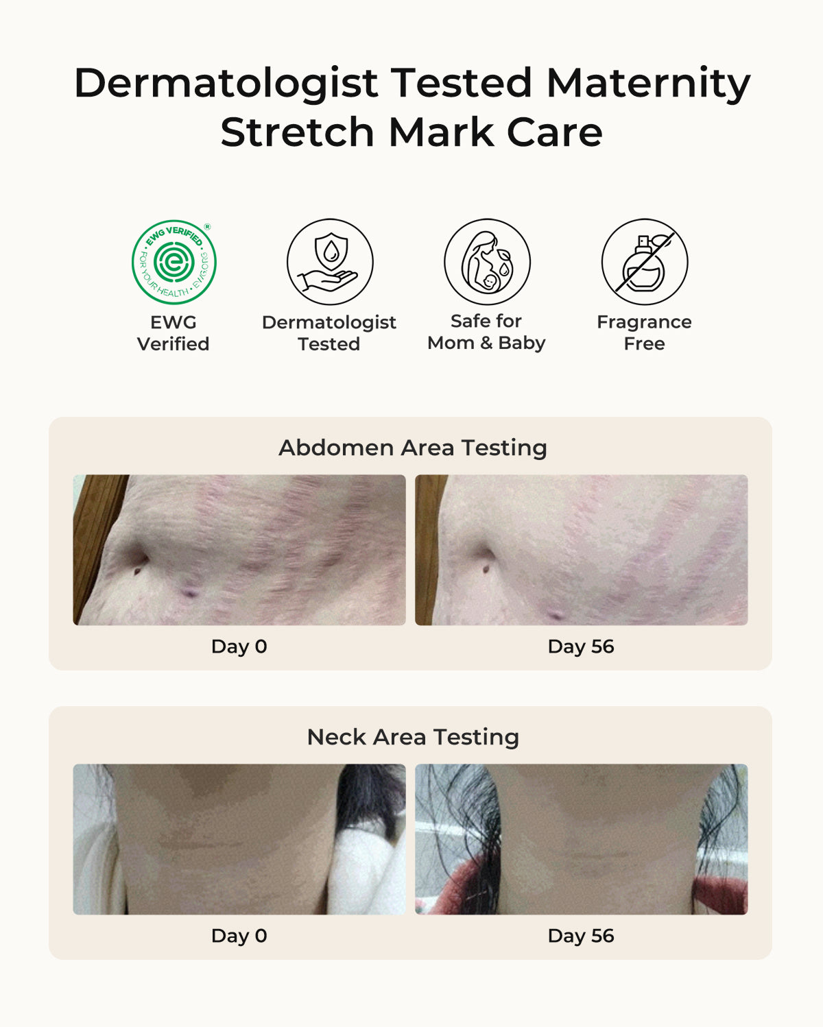 Momcozy Pro-Collagen Belly Firming Moisturizer Stretch Mark Cream